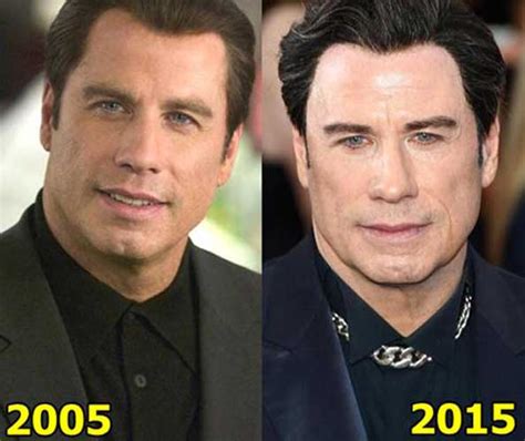 john travolta face lift|John Travolta Plastic Surgery Before And After Face。